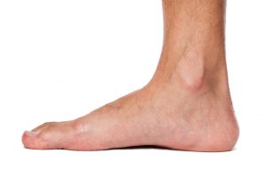 Flat Feet