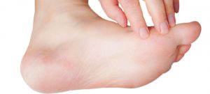 diabetic foot