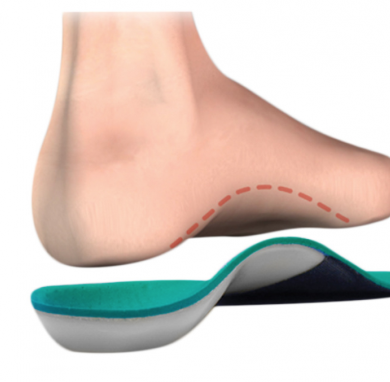 How Long Do Cusotm Orthotics Last?